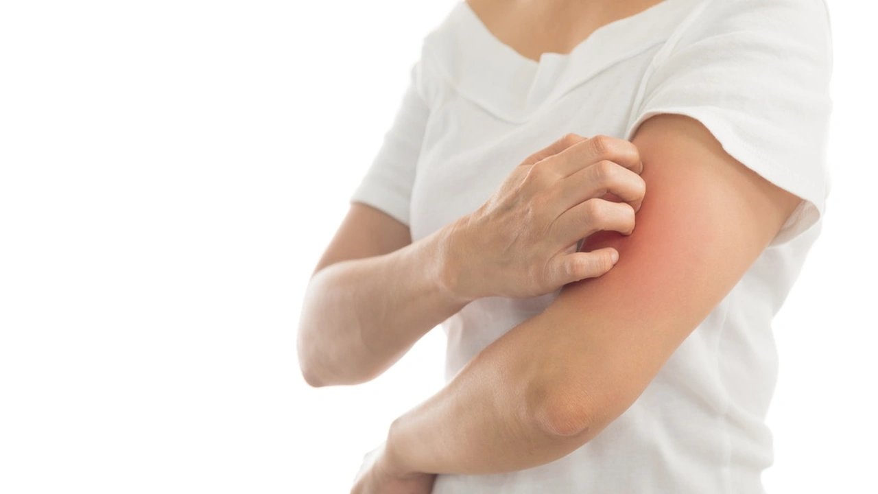 صورة أفضل 8 علاجات لحكة الراس والرقبه