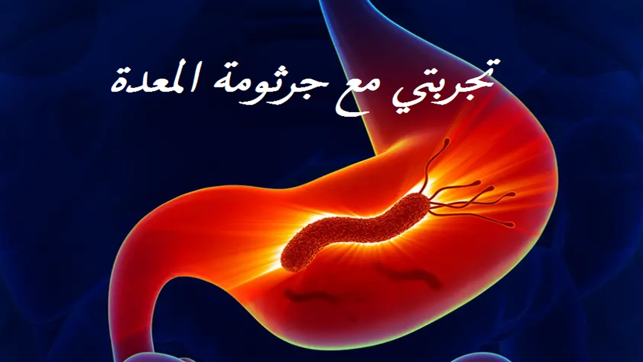صورة تجربتي مع جرثومة المعدة