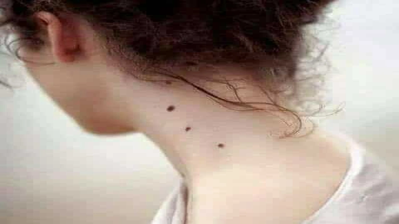 صورة غزل عن الشامة في الرقبة