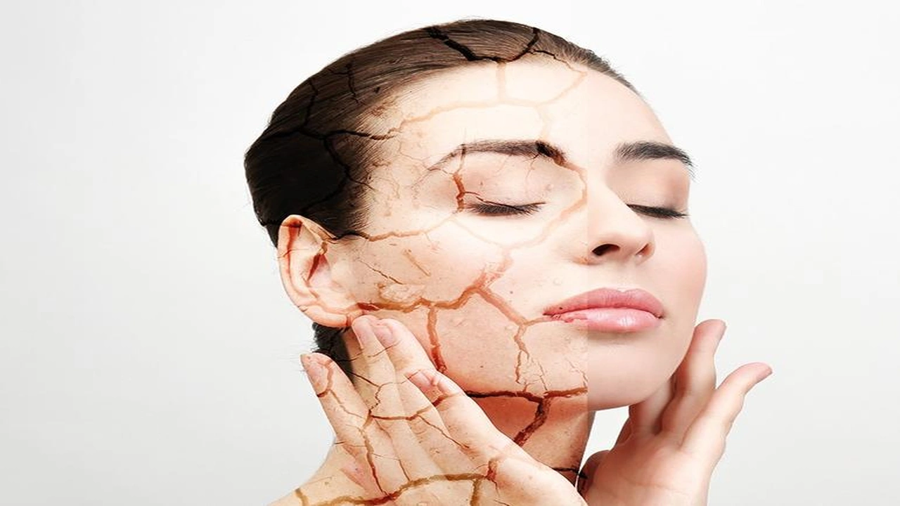صورة 8 علاجات منزلية للبشرة الجافة