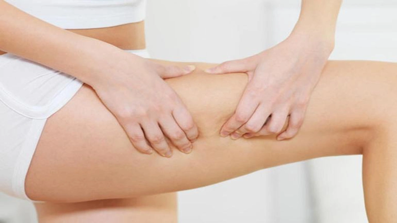 صورة 9 علاجات طبيعية للسيلوليت