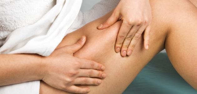 9 علاجات طبيعية للسيلوليت