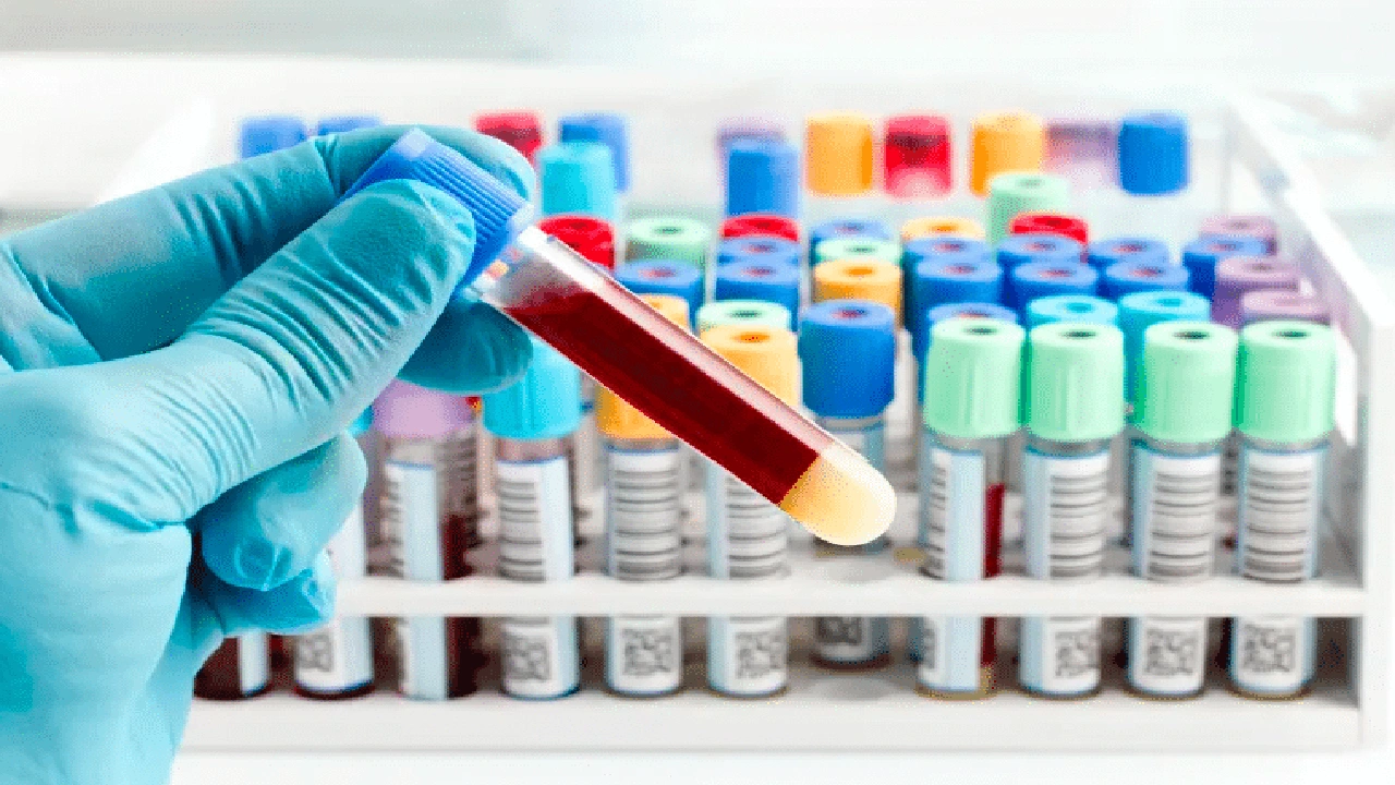 صورة أنواع أنابيب سحب الدم واستخداماتها