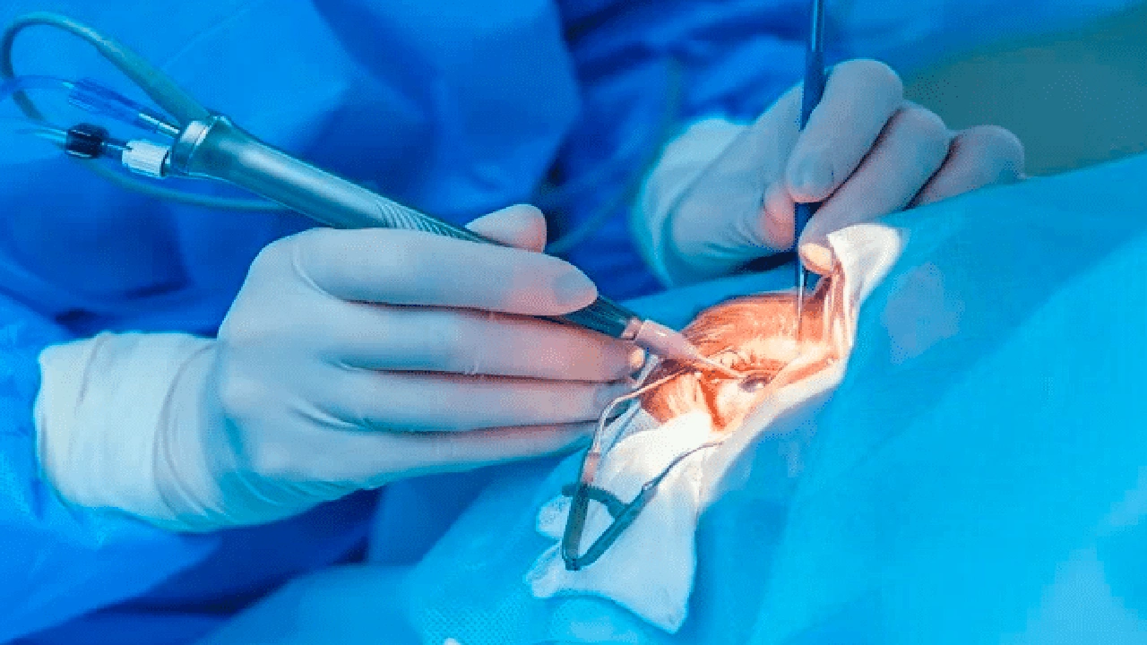 صورة إرشادات بعد حقن العين