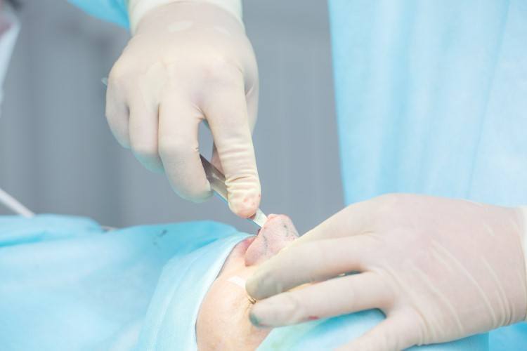 افضل دكتور تجميل انف بالكويت