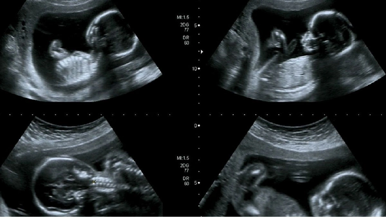 صورة تجاربكم مع الاحلام وجنس الجنين