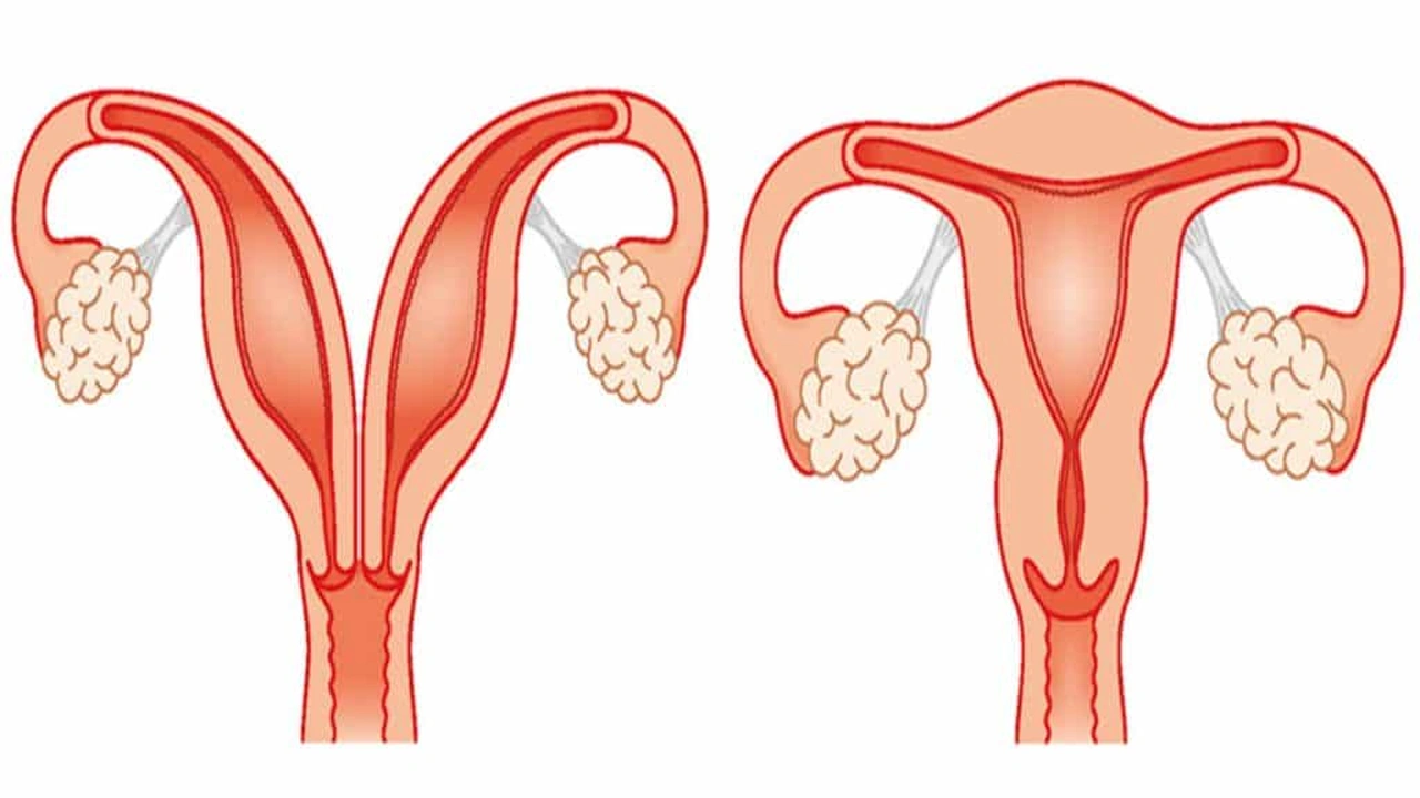 صورة تجاربكم مع الرحم ذو القرنين