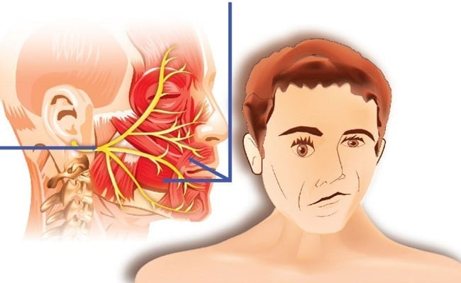 تجاربكم مع العصب السابع