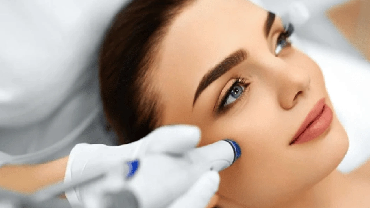 صورة تجاربكم مع الفراكشنال ليزر