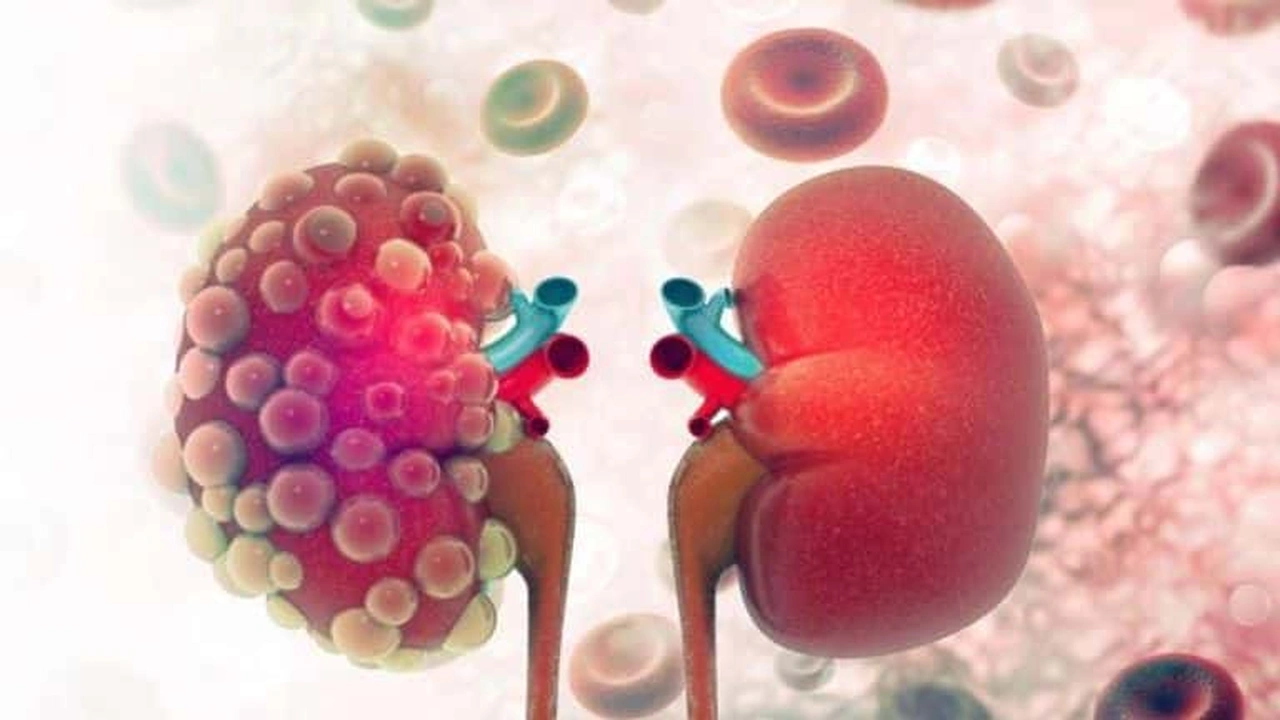 صورة تجاربكم مع الفشل الكلوي