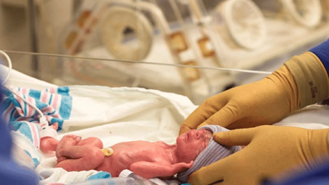 صورة تجاربكم مع الولادة المبكرة