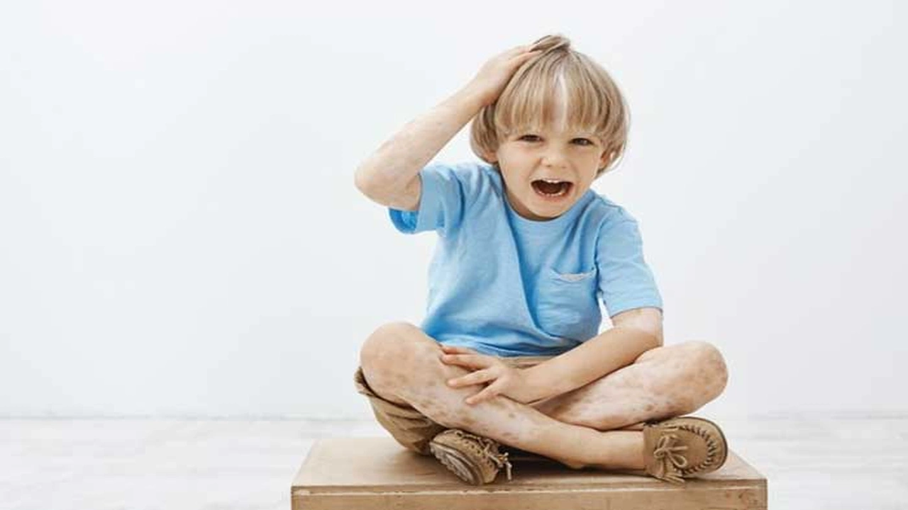 صورة تجاربكم مع بهاق الأطفال