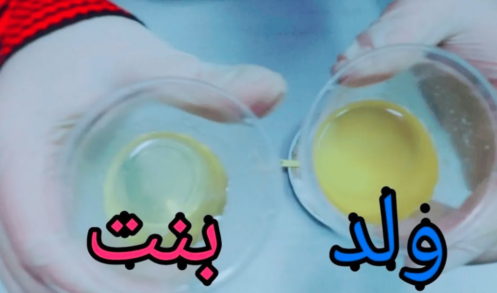 تجاربكم مع لون البول وجنس الجنين
