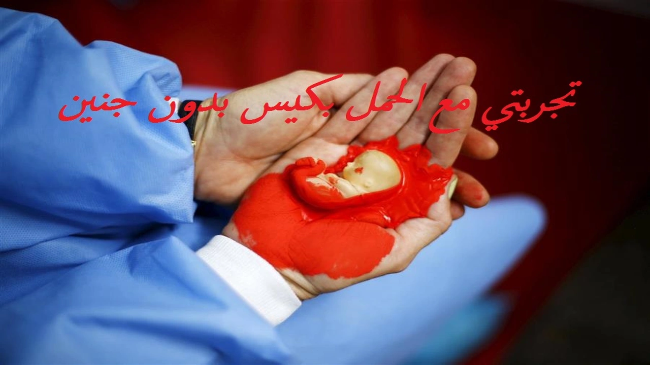 صورة تجربتي مع الحمل بكيس بدون جنين