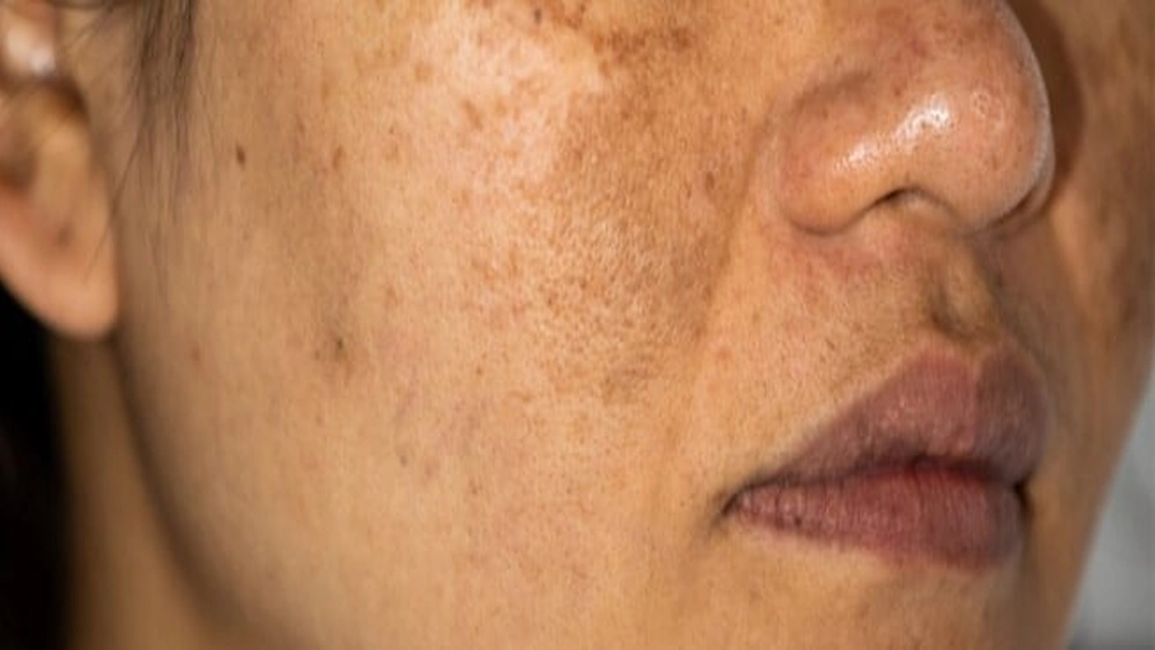 صورة تجربتي مع تصبغات الجسم