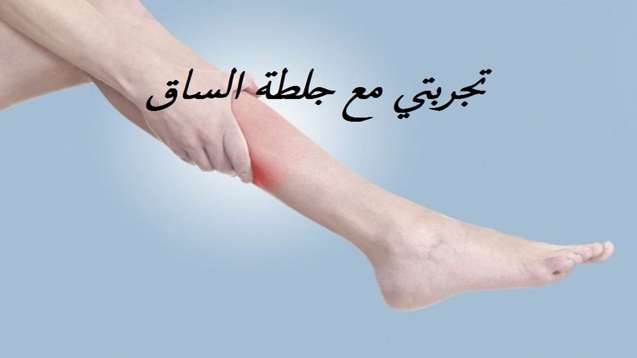 صورة تجربتي مع جلطة الساق