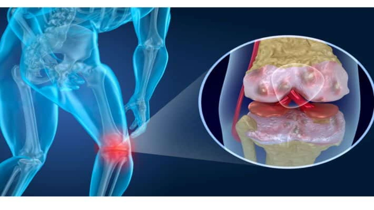 صورة تجربتي مع عملية غضروف الركبة