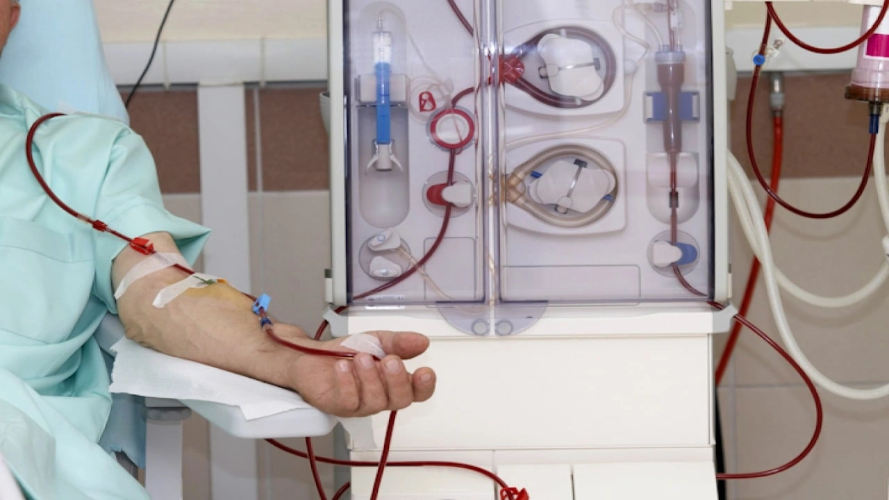 صورة تجربتي مع غسيل الكلى