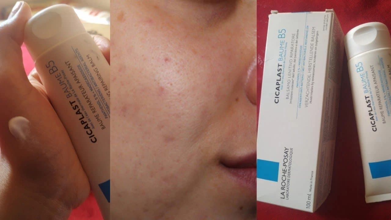 صورة تجربتي مع كريم سيكابلاست