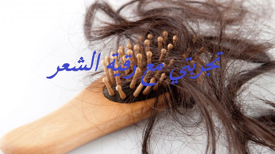 دعاء لشفاء الشعر