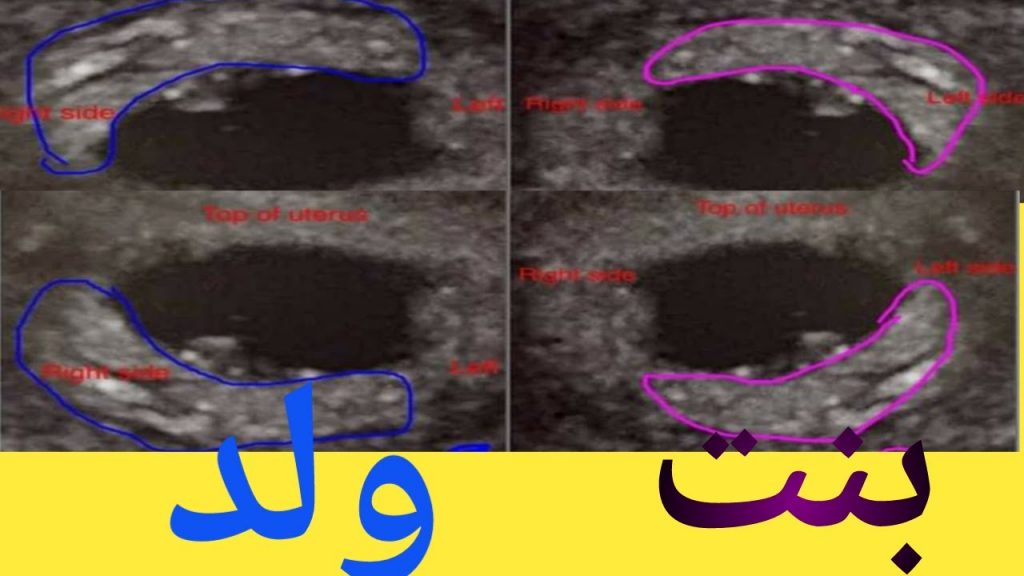 شكل كيس الجنين الذكر في الشهر الثاني