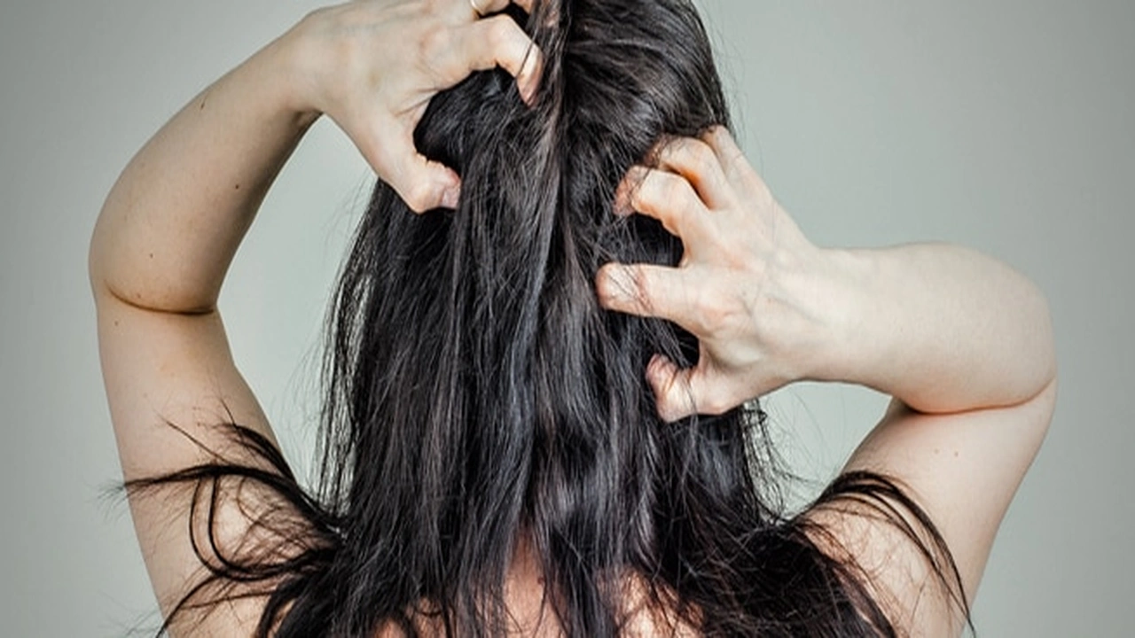 صورة طرق علاج قشرة الشعر الدهني