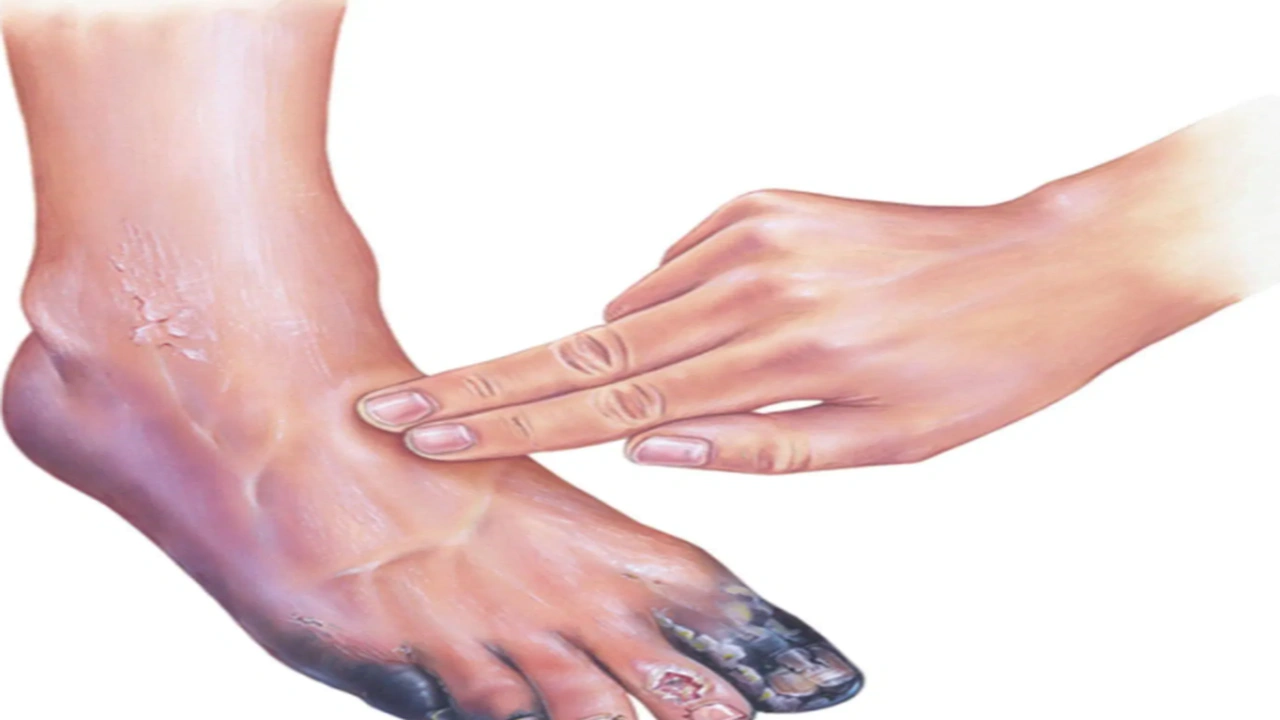 صورة علاج الغرغرينا في جدة