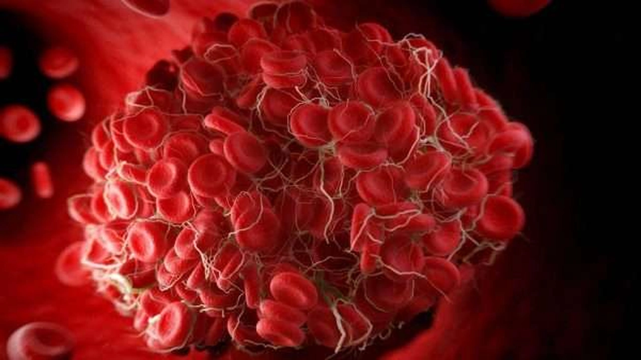 صورة كيف اعرف أن عندي تخثر الدم