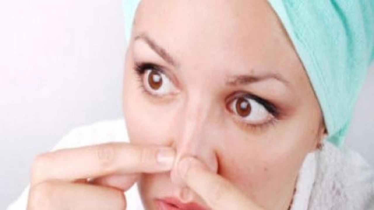 صورة كيفية ازالة الرؤوس السوداء : 8 طرق لإزالة الرؤوس السوداء من الانف 