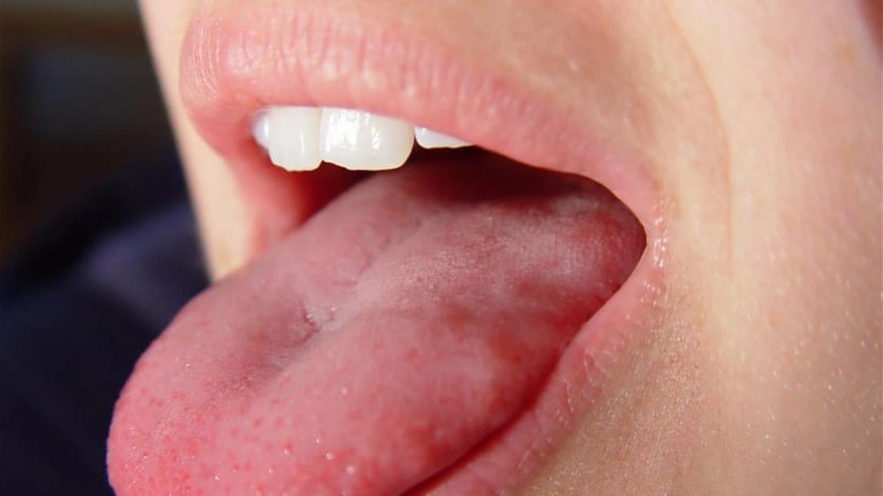 صورة ما سبب تنميل اللسان