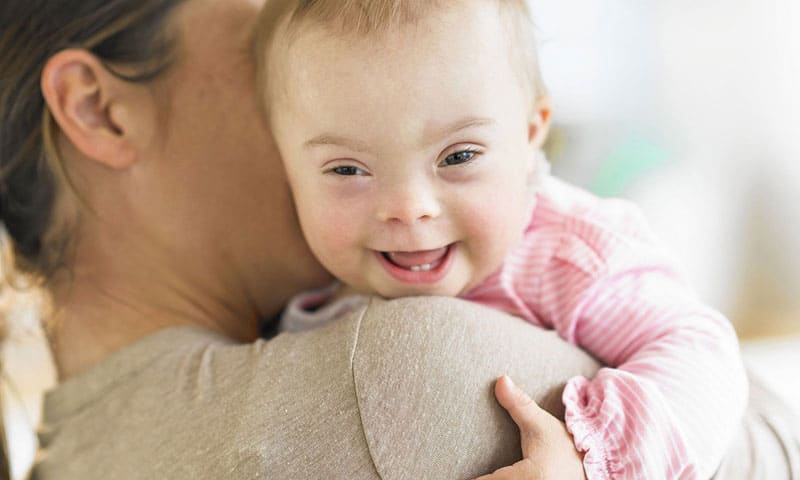 متى تظهر أعراض متلازمة داون