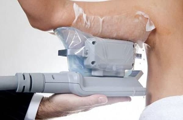 متى تظهر نتائج تجميد الدهون