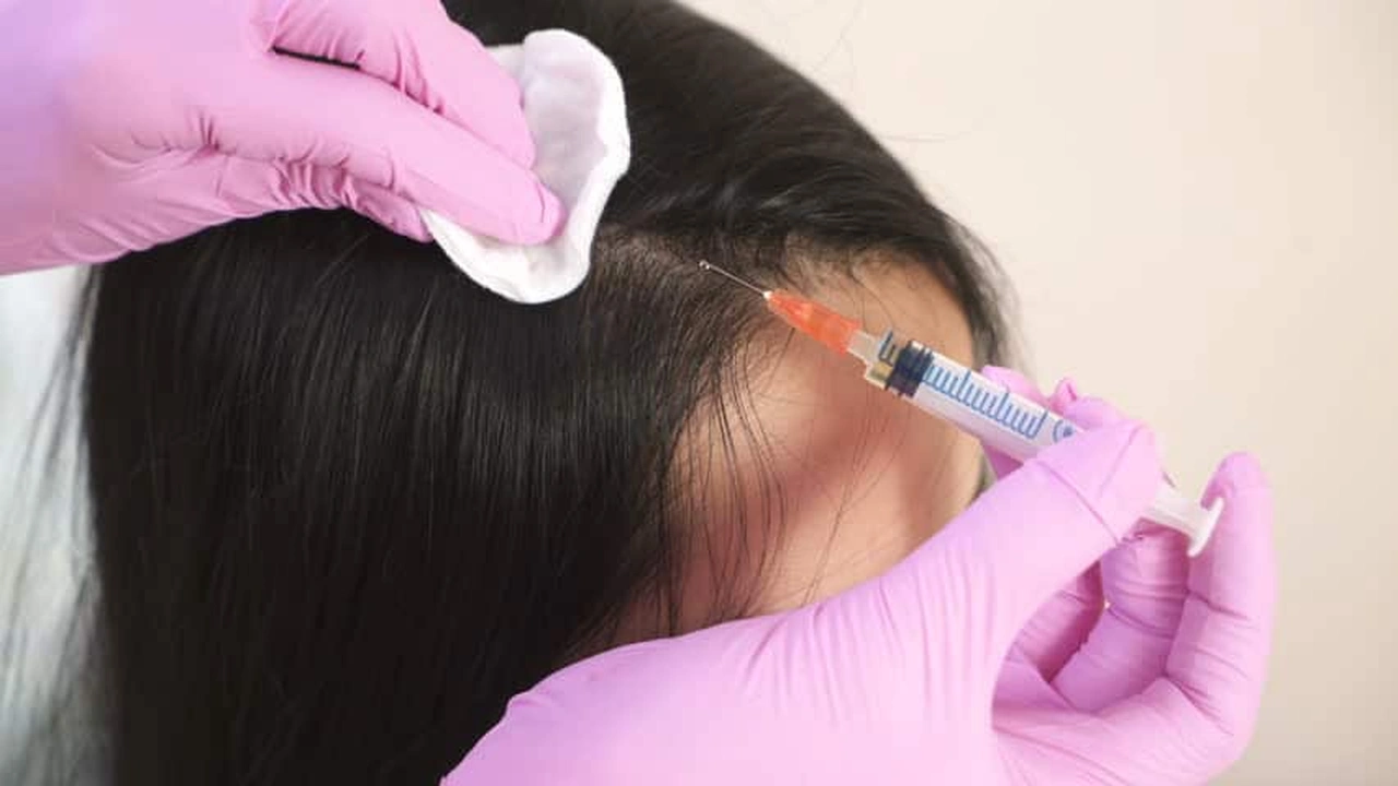 صورة متى تظهر نتيجة حقن البلازما للشعر