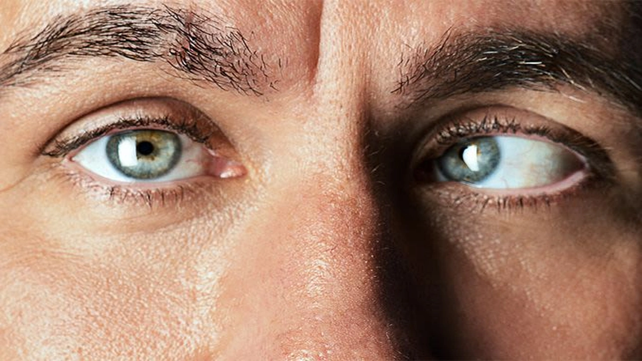 صورة متى تظهر نتيجة عملية الحول