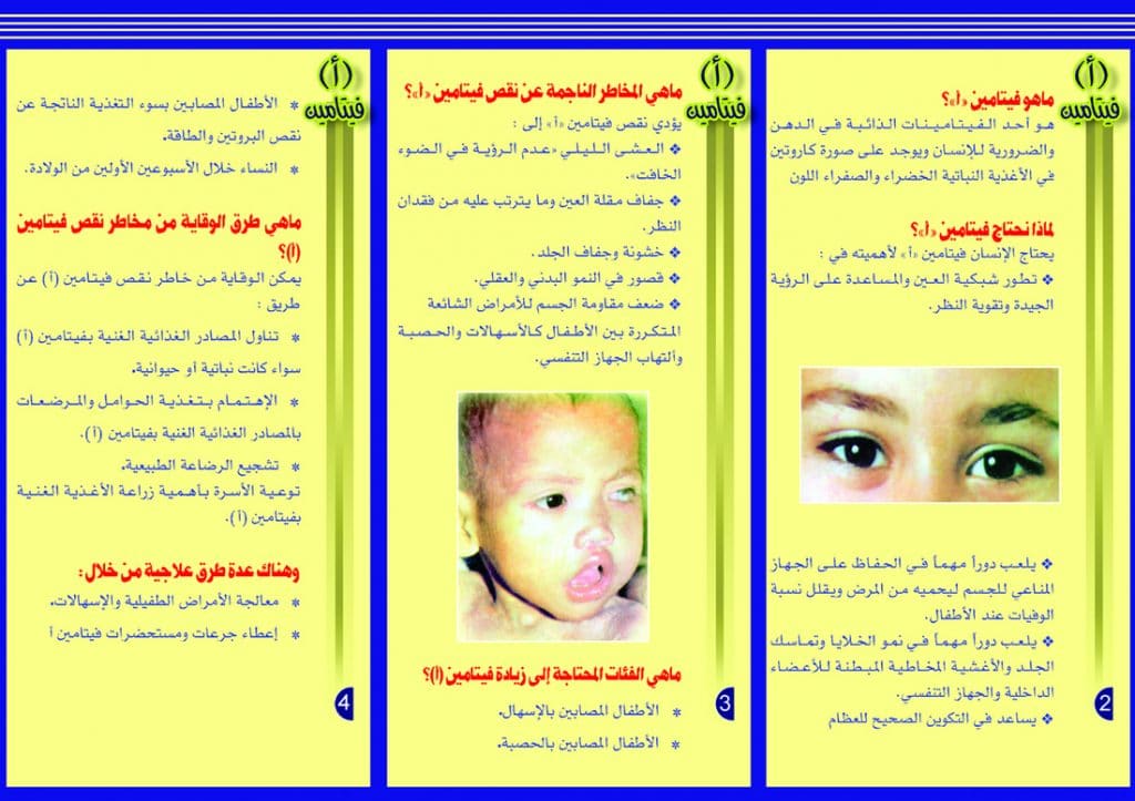 مطويات عن صحة العين