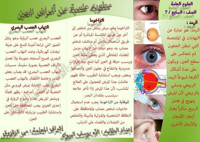 مطويات عن صحة العين
