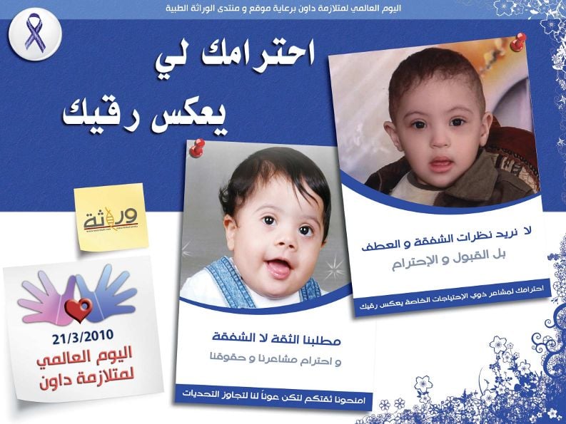 مطويات عن متلازمة داون