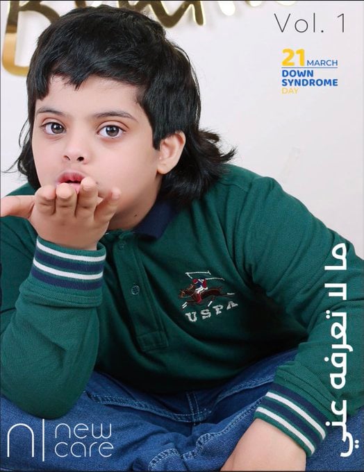 مطويات عن متلازمة داون