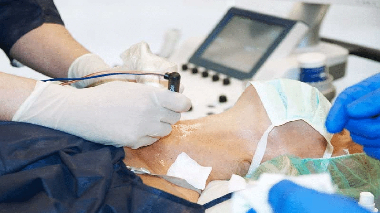 صورة معلومات عن عملية الغدة الدرقية