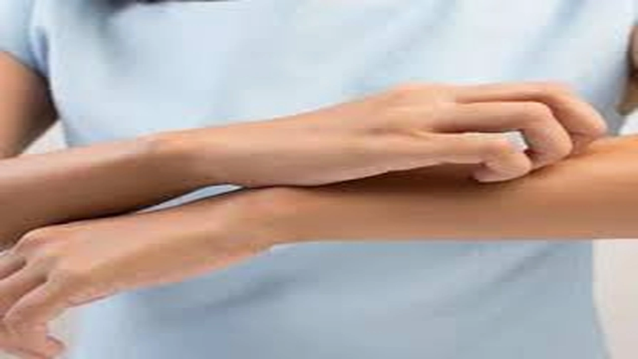 صورة هذه أمور غير متوقعة تسبب لك الحكة 