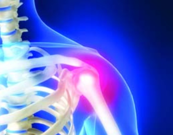 أفضل مسكن لالتهاب المفاصل