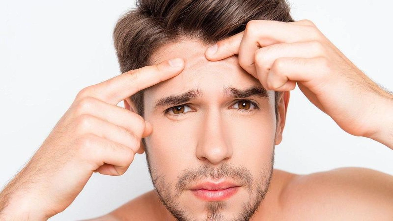 صورة أسباب مشاكل البشرة وعلاقة الهرمونات 