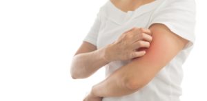 أفضل 8 علاجات لحكة الراس والرقبه