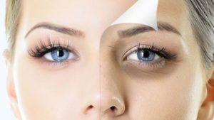 أفضل الطرق لإزالة الهالات السوداء حول العين