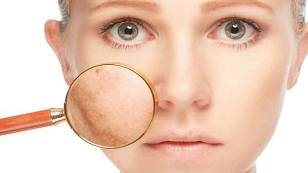 صورة أفضل كريم لازالة الكلف بعد الولادة