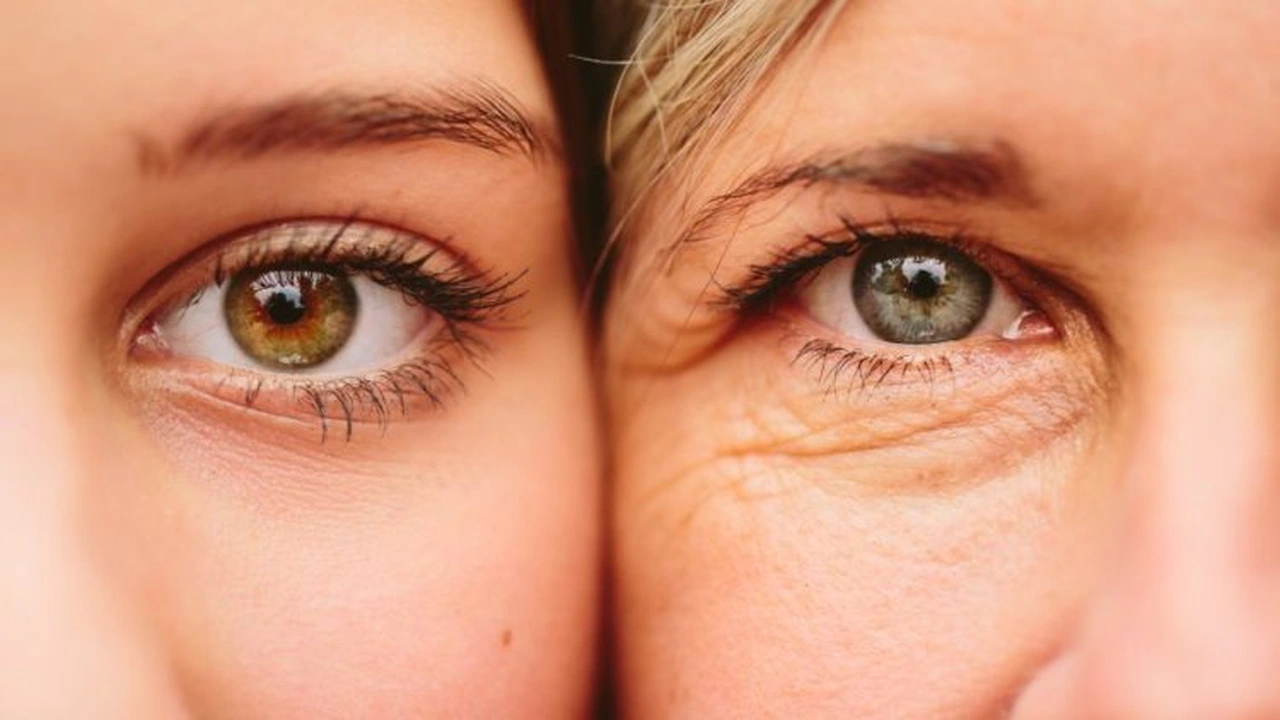 صورة إزالة تجاعيد العين نهائيا