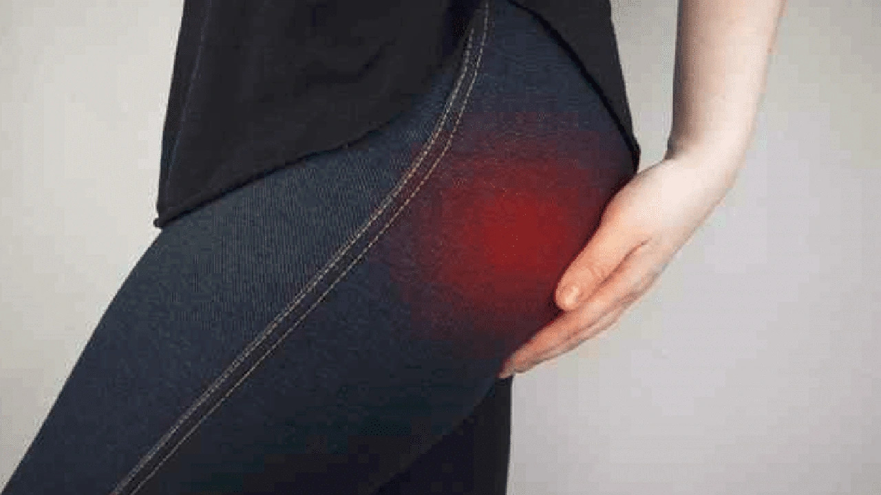 صورة إزالة حبوب المؤخرة وتبييضها
