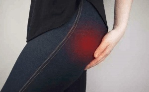 إزالة حبوب المؤخرة وتبييضها