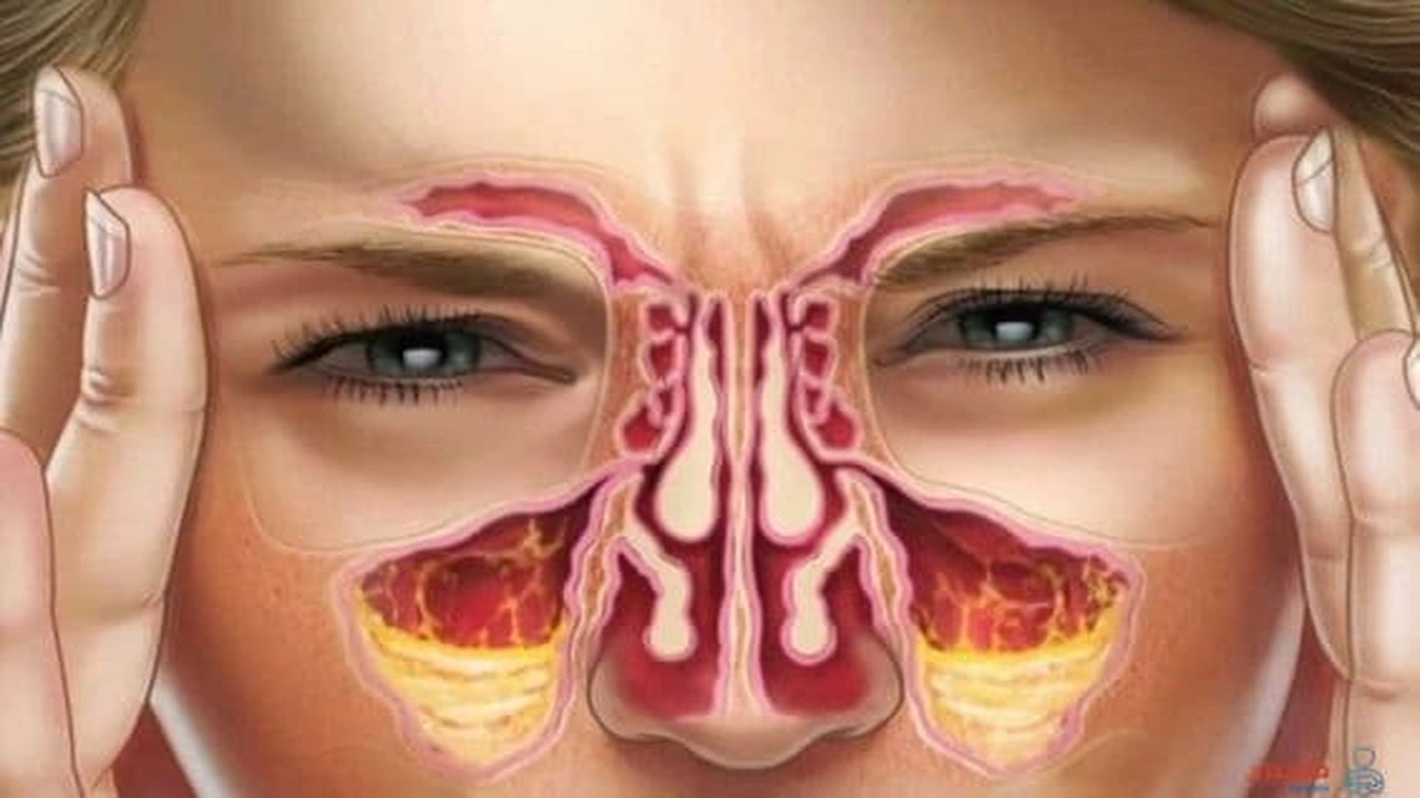 صورة إزالة لحمية الأنف بدون جراحة
