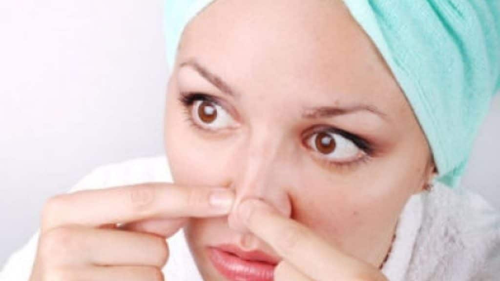 ازالة الرؤوس السوداء من الانف